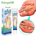 Medicine Ointment Bunion Inflammation Therapy Suitable For Treat Toe Swelling,joint Deformation,numbness Of Limbs Pain Relief
