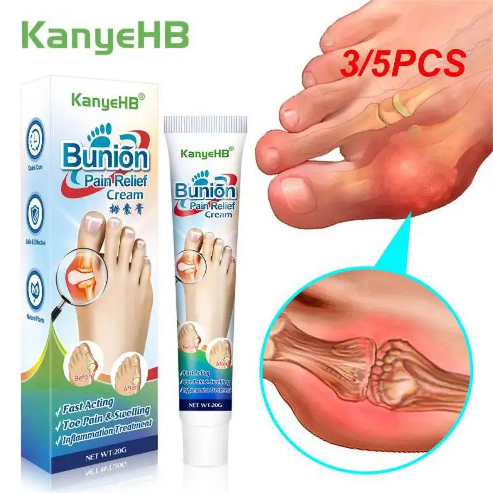 Medicine Ointment Bunion Inflammation Therapy Suitable For Treat Toe Swelling,joint Deformation,numbness Of Limbs Pain Relief