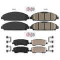 Ameri 320MM Front Disc Brake Rotors Pads Hardware Kit For 2015-2021 Ford